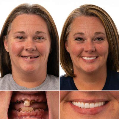 jax implants and dentures|Home 